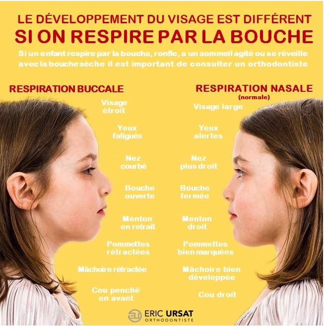 Orthodontie chez l