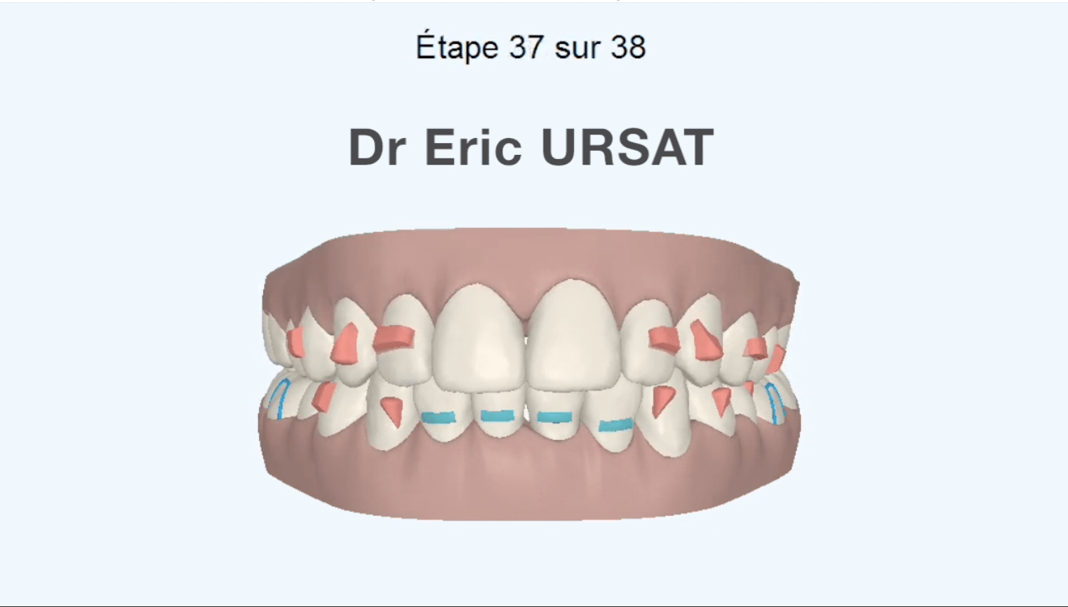 Ortho Gouttières invisibles – Poissy dentiste